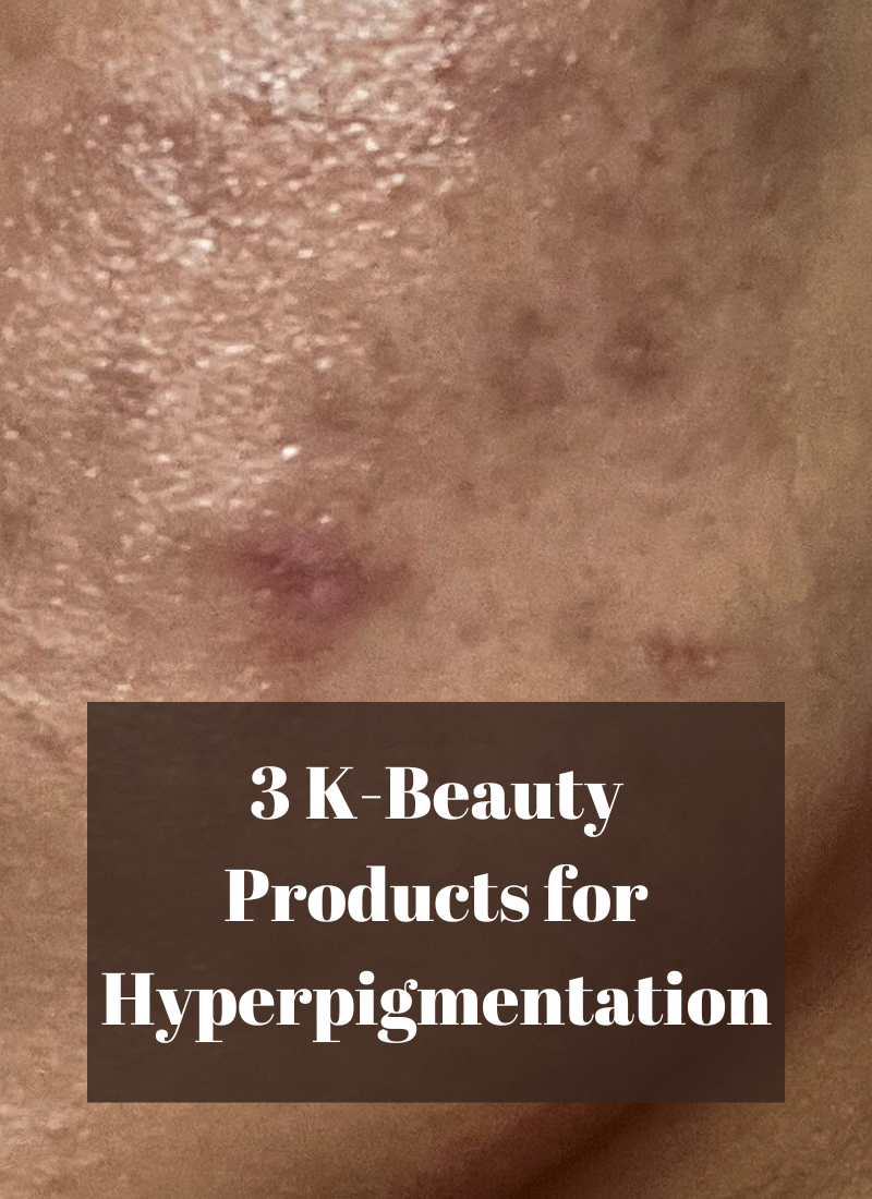 3 K-Beauty Products for Hyperpigmentation